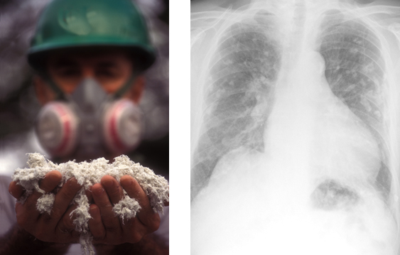 Dustcontrol's article series about the danger with asbestos